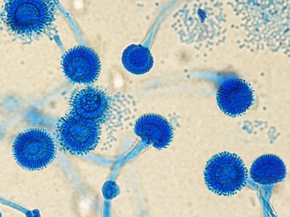 aspergillus