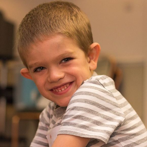 A boy with brittle X chromosome syndrome. Credit: Peter Saxon, Wikipedia 